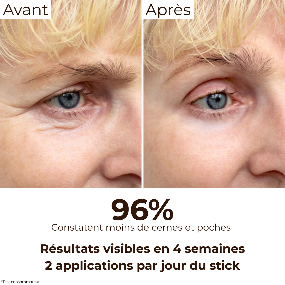 Avant/Après 4 semaines : diminution visible des cernes et poches chez 96% des utilisatrices grâce au stick anti-cernes à la caféine Enkrem, 2 applications par jour.