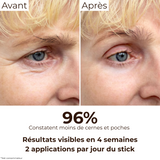 Avant/Après 4 semaines : diminution visible des cernes et poches chez 96% des utilisatrices grâce au stick anti-cernes à la caféine Enkrem, 2 applications par jour.