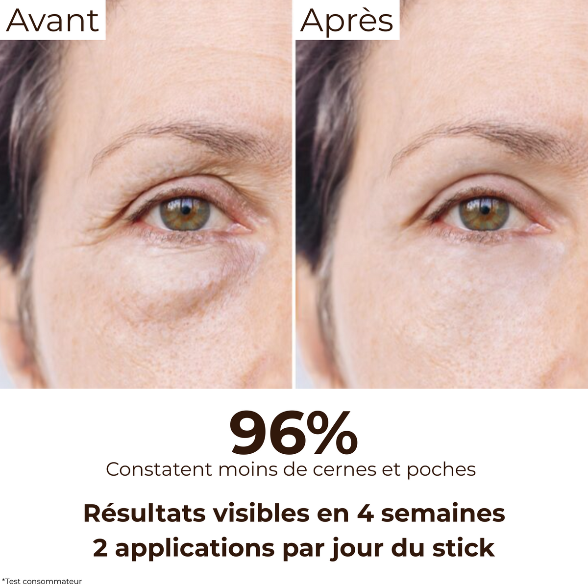 Comparatif Avant/Après : réduction des cernes et poches après 4 semaines d’utilisation régulière du stick anti-cernes à la caféine Enkrem, 96% de satisfaction.