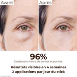 Comparatif Avant/Après : réduction des cernes et poches après 4 semaines d’utilisation régulière du stick anti-cernes à la caféine Enkrem, 96% de satisfaction.