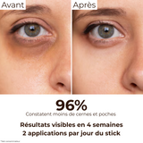 Comparatif Avant/Après : atténuation visible des cernes foncés après 4 semaines avec le stick anti-cernes à la caféine Enkrem, 96% d’utilisatrices satisfaites.
