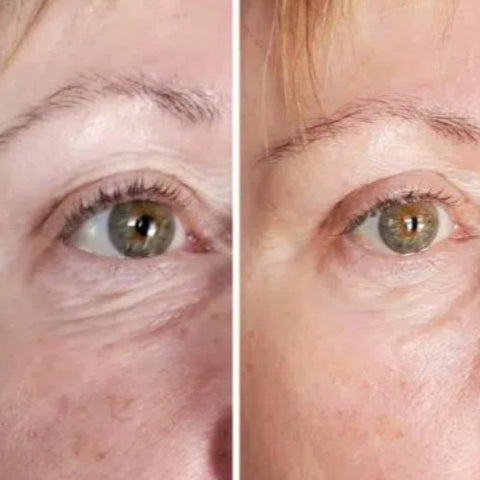 Avant-après montrant une peau visiblement plus lisse au niveau du contour des yeux après utilisation du stick anti-cernes à la caféine Enkrem