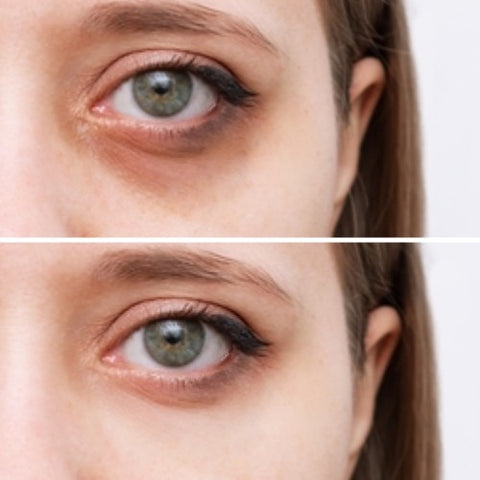 Avant-après montrant l’uniformisation du teint brun et l’amélioration de l’aspect du contour des yeux grâce au stick anti-cernes à la caféine Enkrem