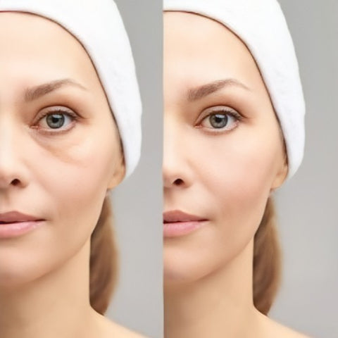 Image montrant des cernes visibles au niveau du contour des yeux, ciblés par le stick anti-cernes à la caféine Enkrem pour un regard plus frais