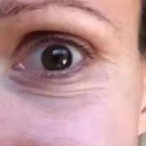 Gros plan sur un œil avec des cernes visibles, illustrant une zone de fatigue ciblée par le stick anti-cernes à la caféine Enkrem