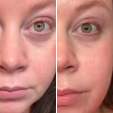 Image montrant des poches sous les yeux causées par la fatigue, ciblées par le stick anti-cernes à la caféine Enkrem pour un regard reposé